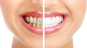 6_2PERIODONCIA 6_2PERIODONCIA