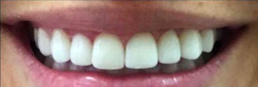 After